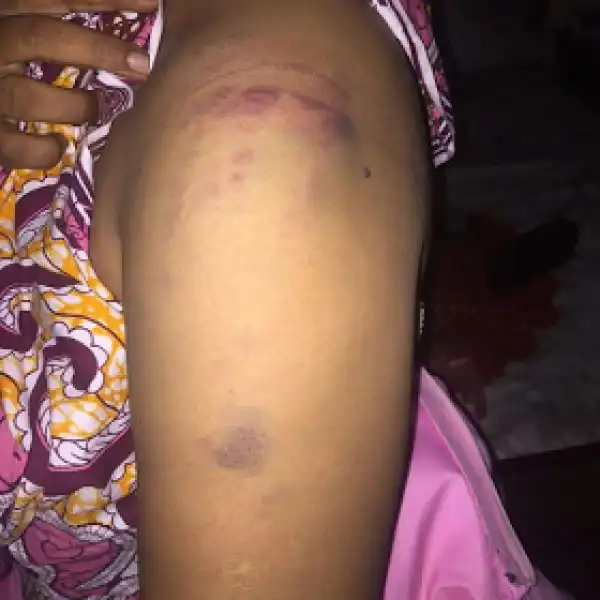 Woman beaten by her step-daughter in Kebbi State